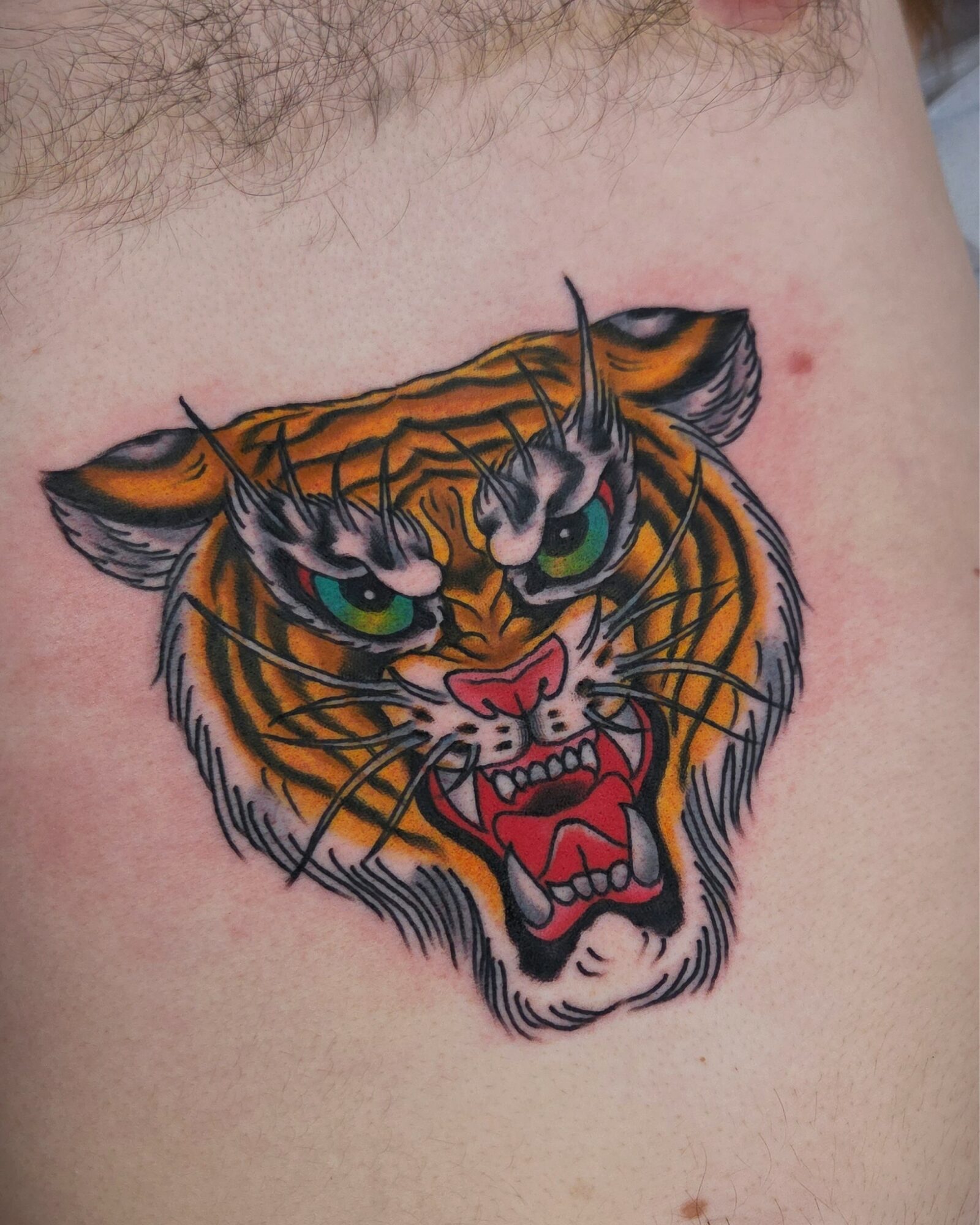 Colorful tiger head tattoo with green eyes, open mouth, showing teeth, on skin with hair and small red spots.