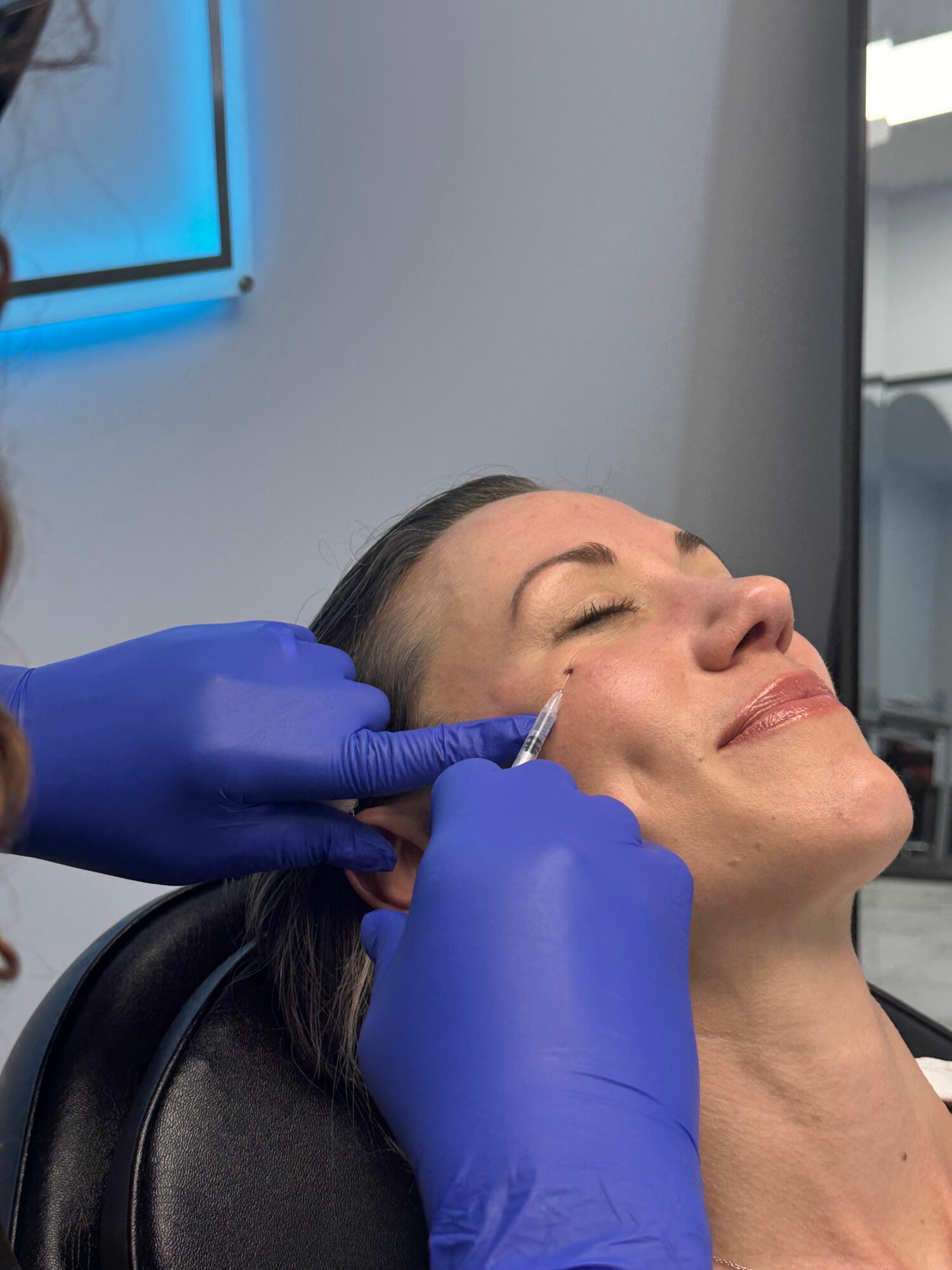 Woman receiving a cosmetic injection in her forehead while lying down, with a healthcare professional wearing blue gloves.