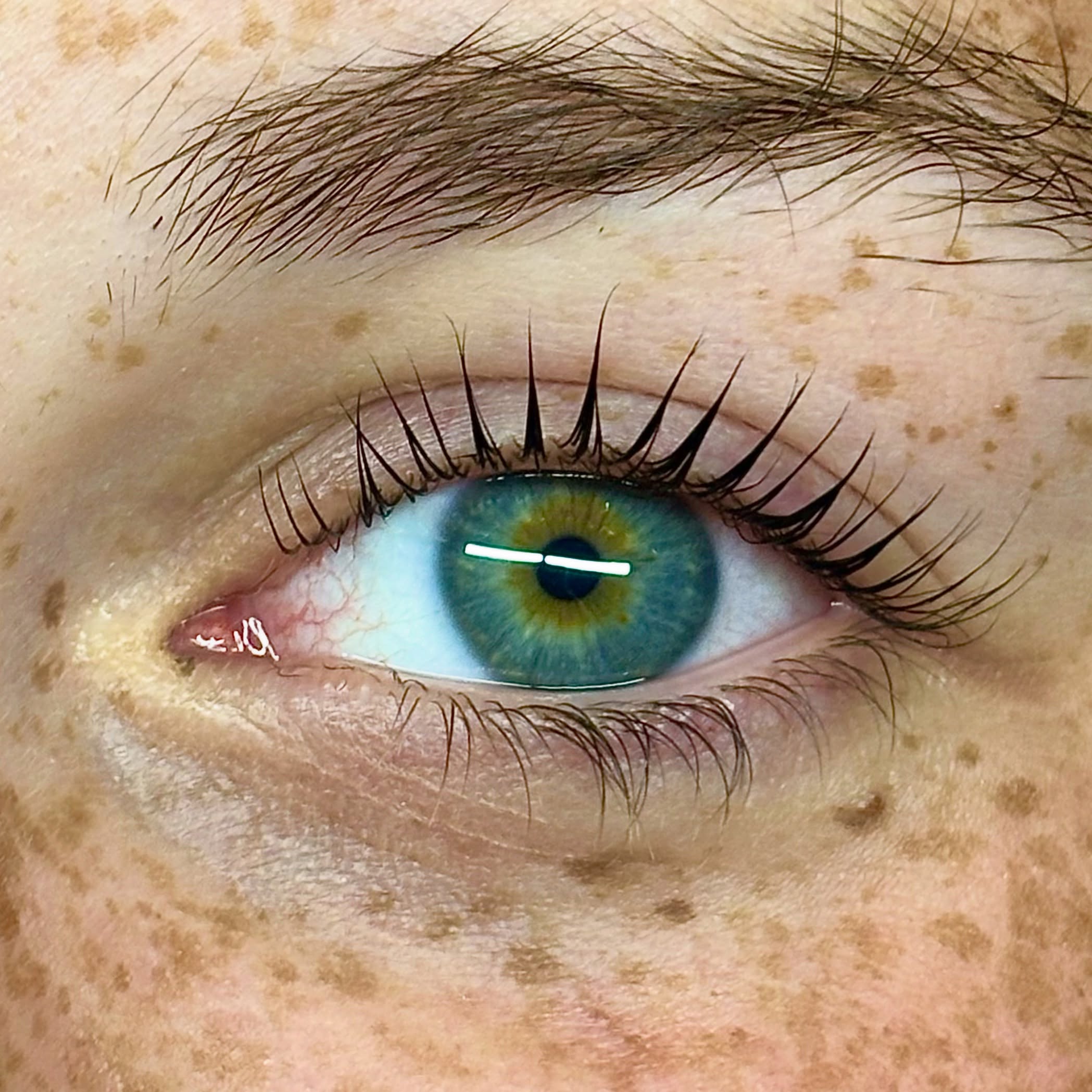 Close-up of a blue eye with visible eyelashes and eyebrow, surrounded by freckles and skin texture.