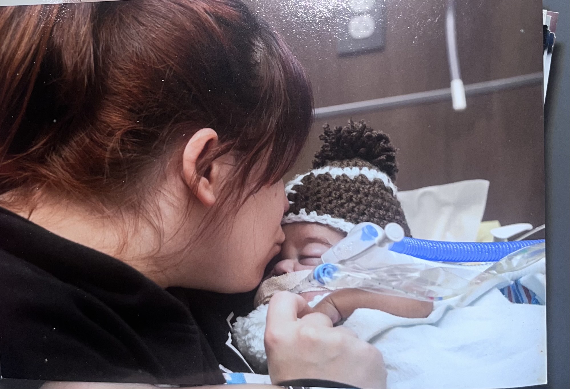 Adult holding a baby with a breathing tube in a hospital bed, close-up of faces and medical equipment.
