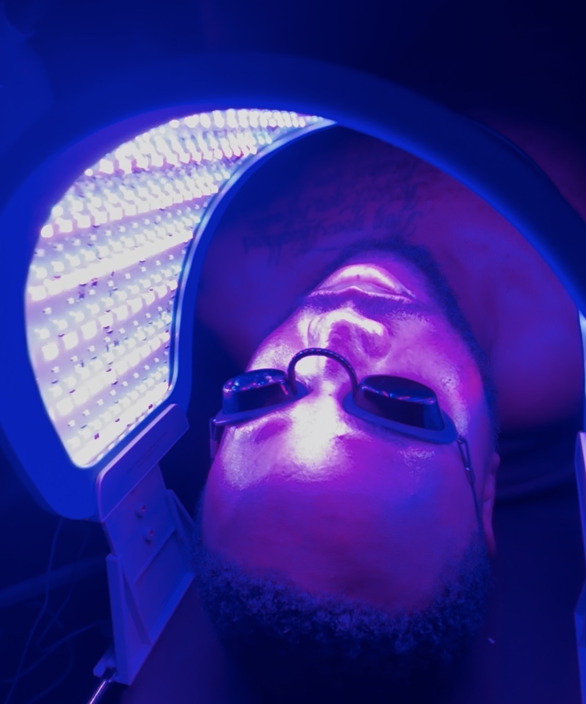 Person lying under a purple and blue light, wearing protective glasses, with their face illuminated by the light.